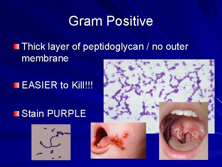 Gram Positive Thick layer of peptidoglycan / no outer membrane EASIER to Kill!!! Stain