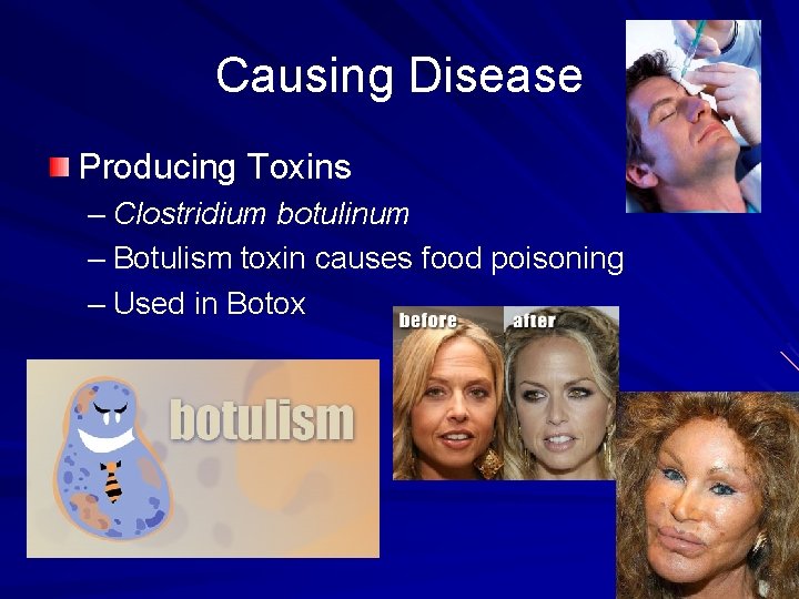 Causing Disease Producing Toxins – Clostridium botulinum – Botulism toxin causes food poisoning –