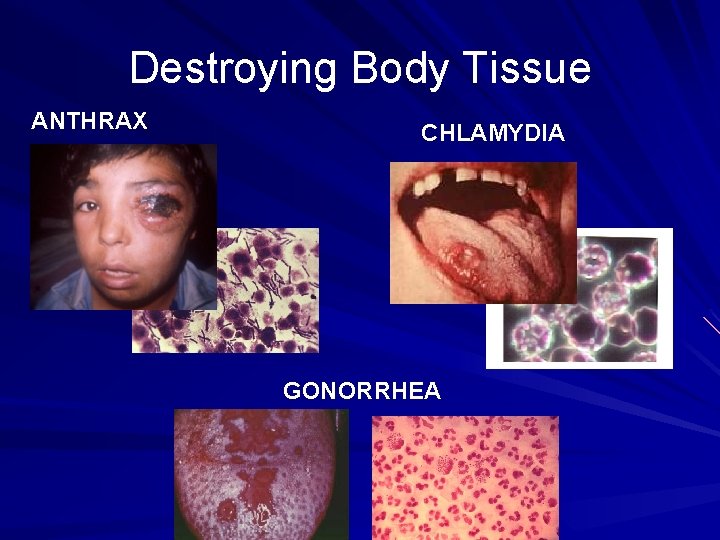 Destroying Body Tissue ANTHRAX CHLAMYDIA GONORRHEA 