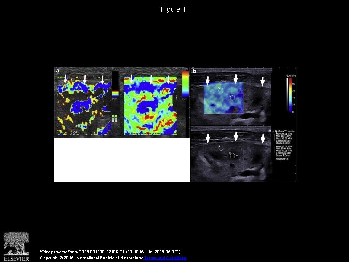 Figure 1 Kidney International 2016 901199 -1210 DOI: (10. 1016/j. kint. 2016. 042) Copyright