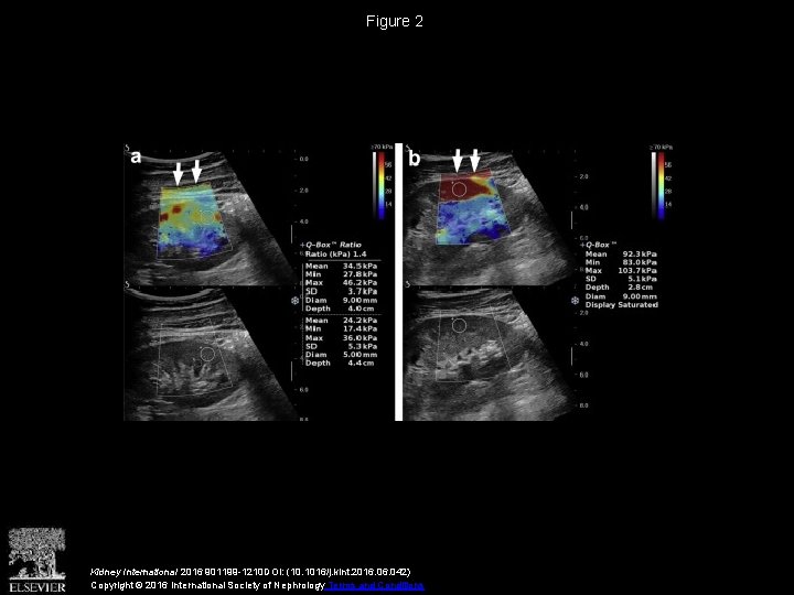 Figure 2 Kidney International 2016 901199 -1210 DOI: (10. 1016/j. kint. 2016. 042) Copyright