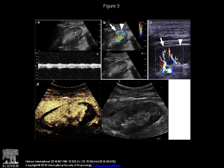 Figure 3 Kidney International 2016 901199 -1210 DOI: (10. 1016/j. kint. 2016. 042) Copyright