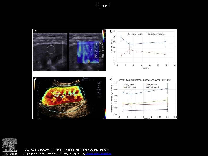 Figure 4 Kidney International 2016 901199 -1210 DOI: (10. 1016/j. kint. 2016. 042) Copyright