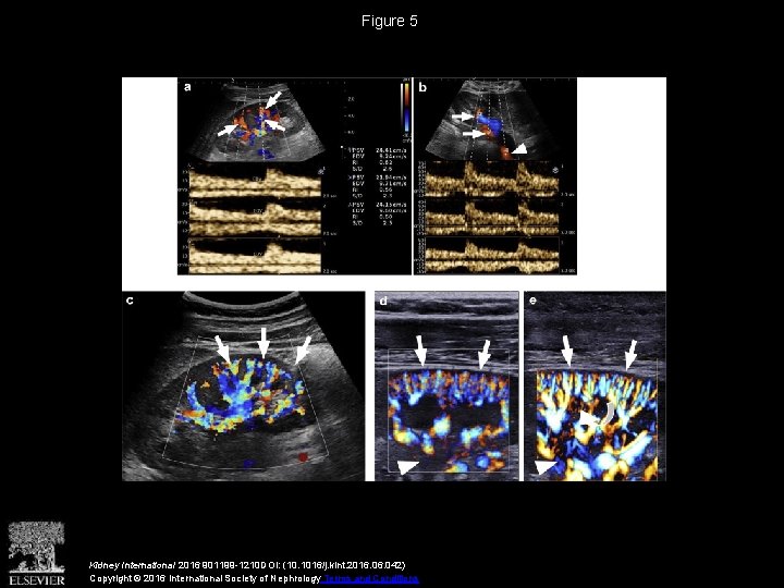 Figure 5 Kidney International 2016 901199 -1210 DOI: (10. 1016/j. kint. 2016. 042) Copyright