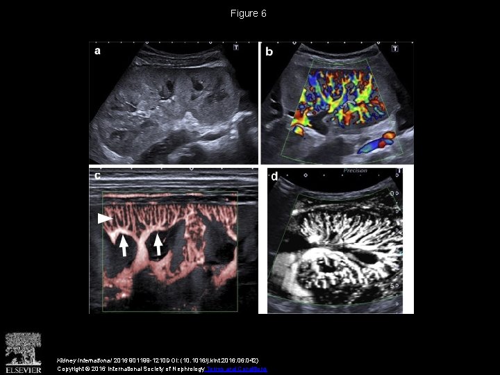 Figure 6 Kidney International 2016 901199 -1210 DOI: (10. 1016/j. kint. 2016. 042) Copyright