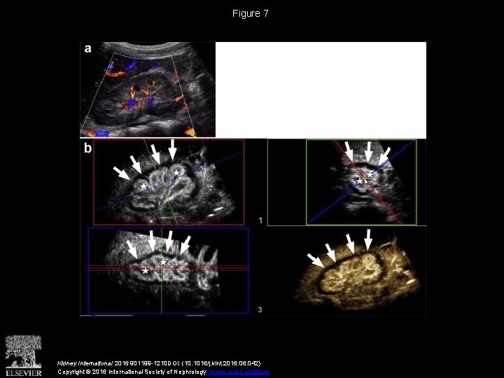 Figure 7 Kidney International 2016 901199 -1210 DOI: (10. 1016/j. kint. 2016. 042) Copyright