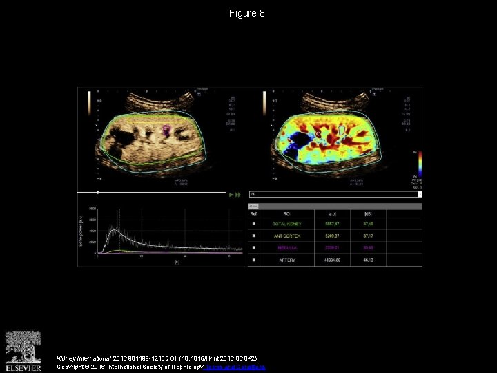 Figure 8 Kidney International 2016 901199 -1210 DOI: (10. 1016/j. kint. 2016. 042) Copyright