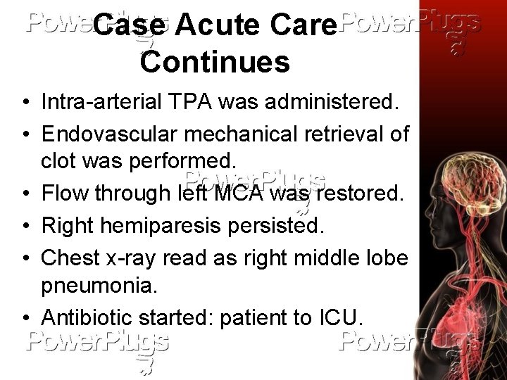 Case Acute Care Continues • Intra-arterial TPA was administered. • Endovascular mechanical retrieval of