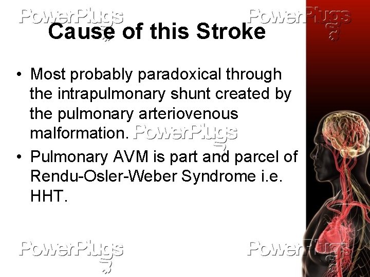 Cause of this Stroke • Most probably paradoxical through the intrapulmonary shunt created by
