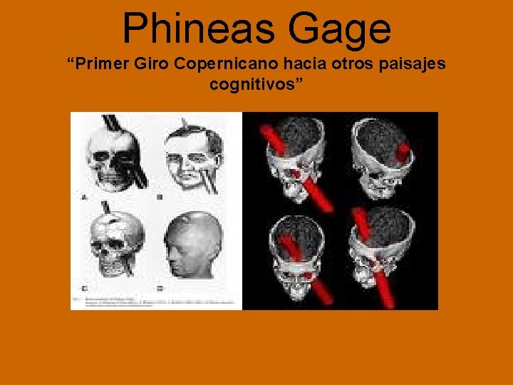 Phineas Gage “Primer Giro Copernicano hacia otros paisajes cognitivos” 