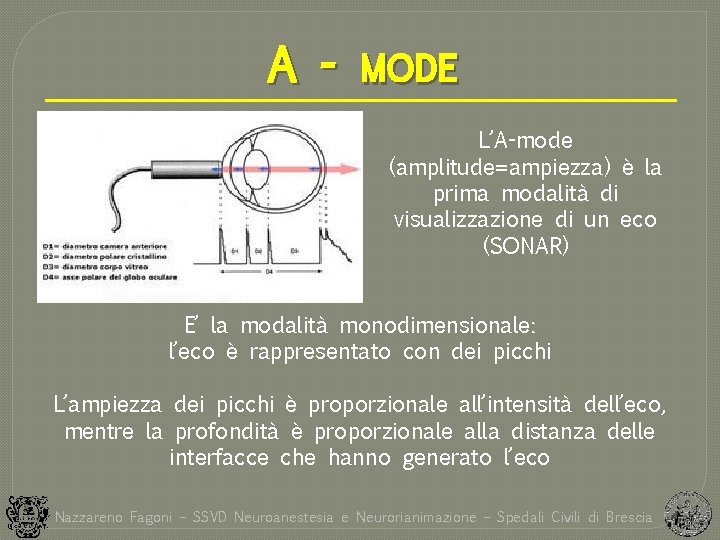 A - MODE L’A-mode (amplitude=ampiezza) è la prima modalità di visualizzazione di un eco