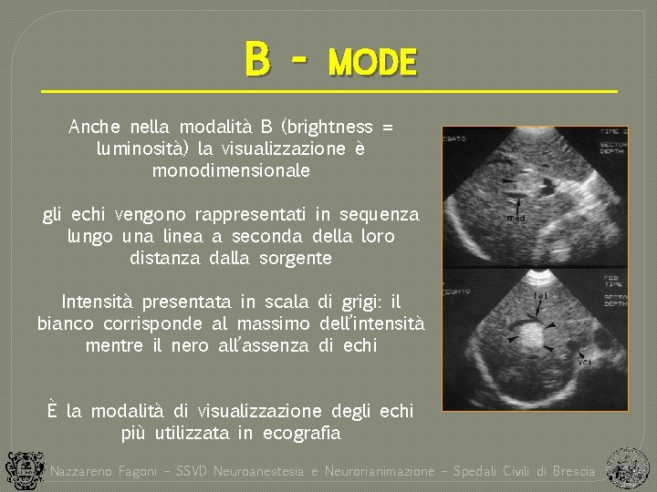B - MODE Anche nella modalità B (brightness = luminosità) la visualizzazione è monodimensionale