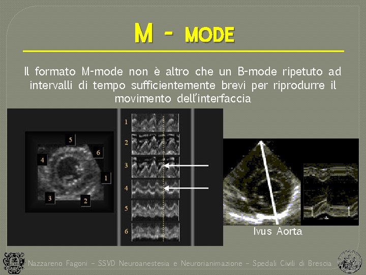 M - MODE Il formato M-mode non è altro che un B-mode ripetuto ad