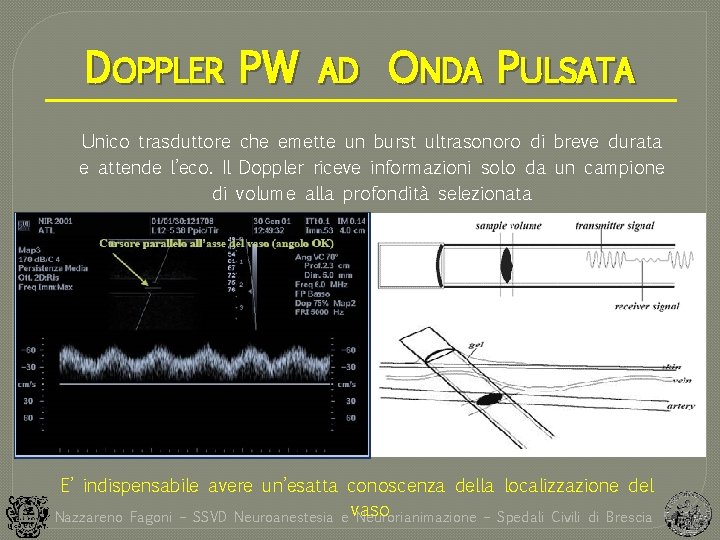 DOPPLER PW AD ONDA PULSATA Unico trasduttore che emette un burst ultrasonoro di breve