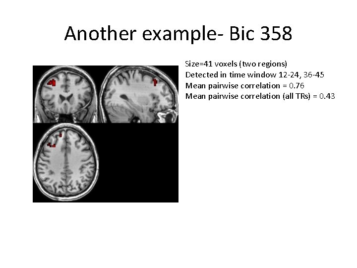 Another example- Bic 358 Size=41 voxels (two regions) Detected in time window 12 -24,