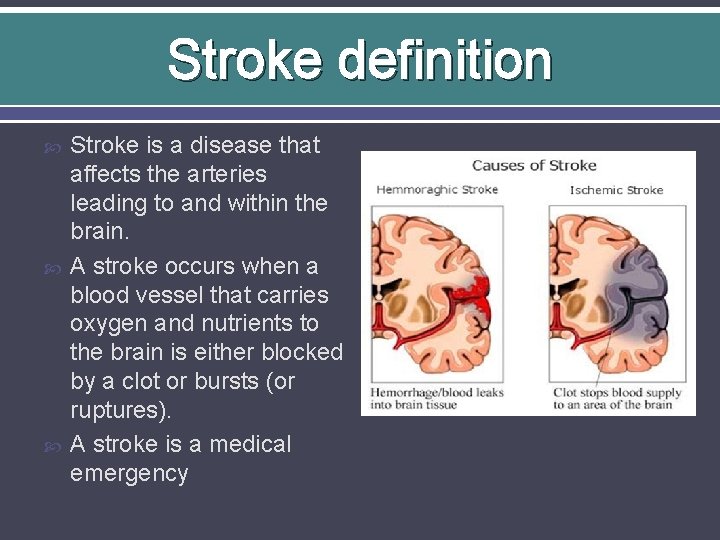 Stroke definition Stroke is a disease that affects the arteries leading to and within