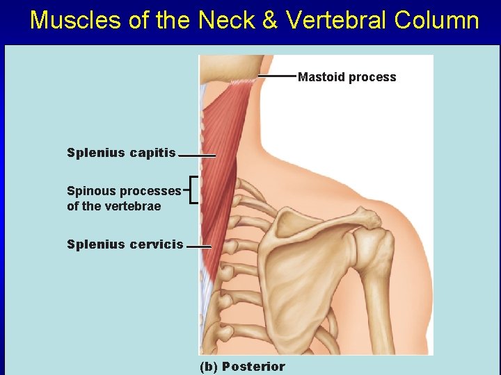 Muscles of the Neck & Vertebral Column Mastoid process Splenius capitis Spinous processes of