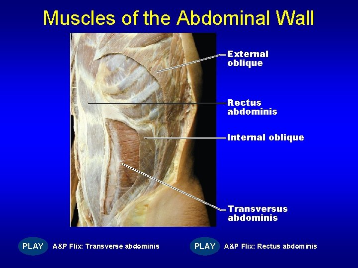 Muscles of the Abdominal Wall External oblique Rectus abdominis Internal oblique Transversus abdominis PLAY
