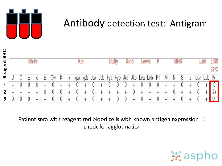 Reagent RBC Antibody detection test: Antigram 1 2 3 Patient sera with reagent red