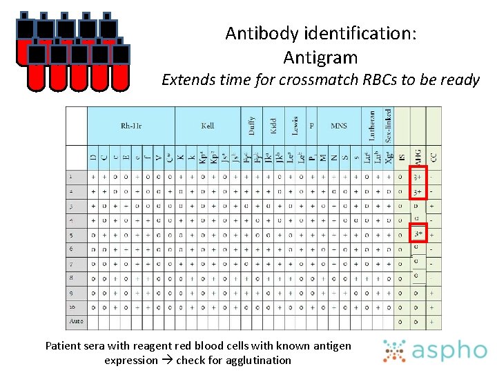 Antibody identification: Antigram Extends time for crossmatch RBCs to be ready Patient sera with