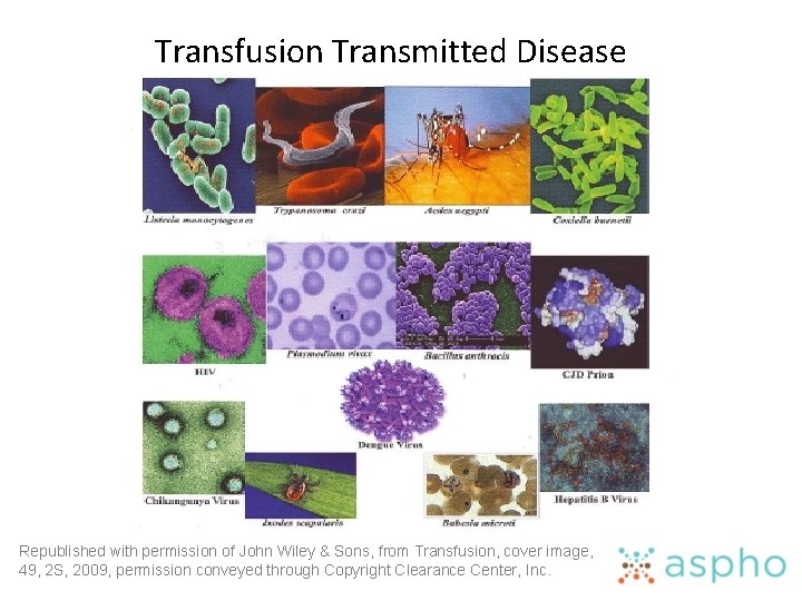 Transfusion Transmitted Disease Republished with permission of John Wiley & Sons, from Transfusion, cover