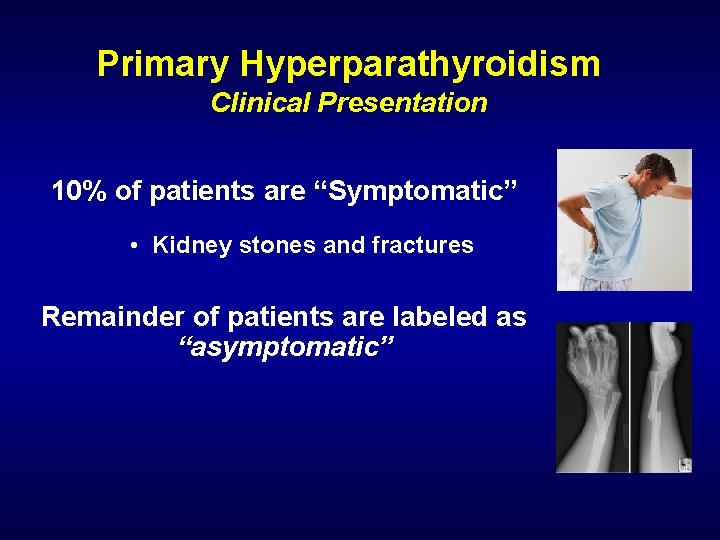 Primary Hyperparathyroidism Clinical Presentation 10% of patients are “Symptomatic” • Kidney stones and fractures