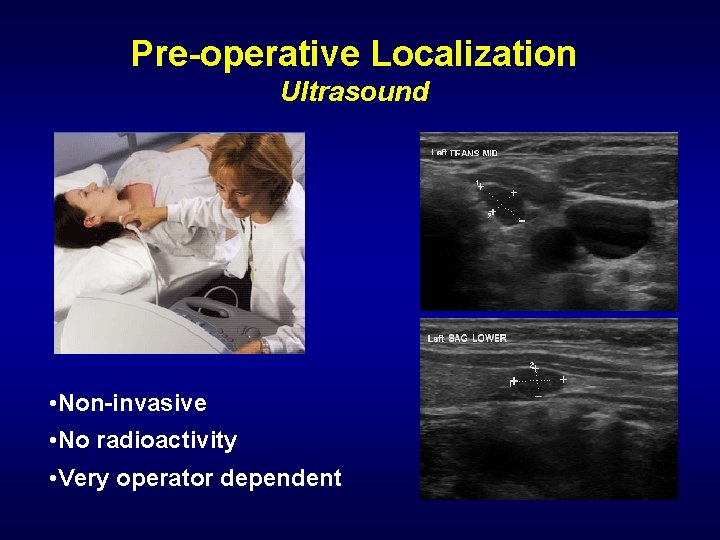 Pre-operative Localization Ultrasound • Non-invasive • No radioactivity • Very operator dependent 