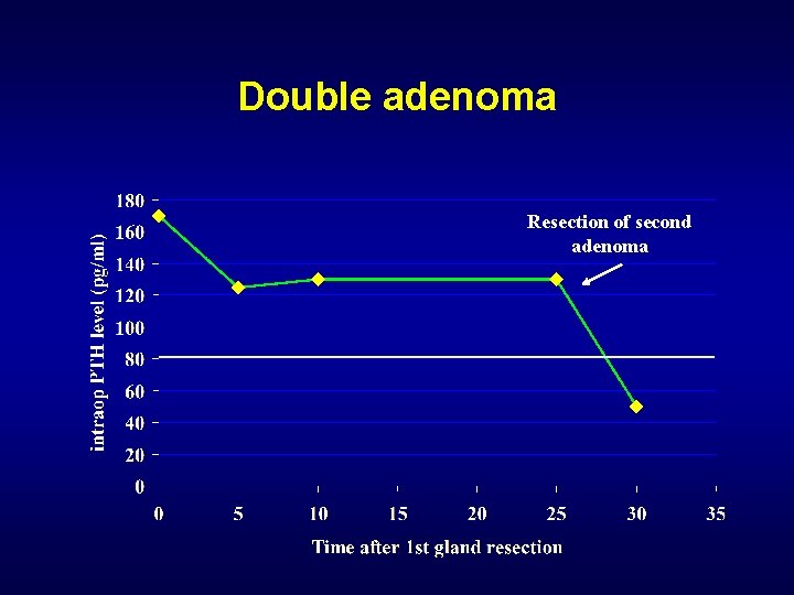 Double adenoma Resection of second adenoma 