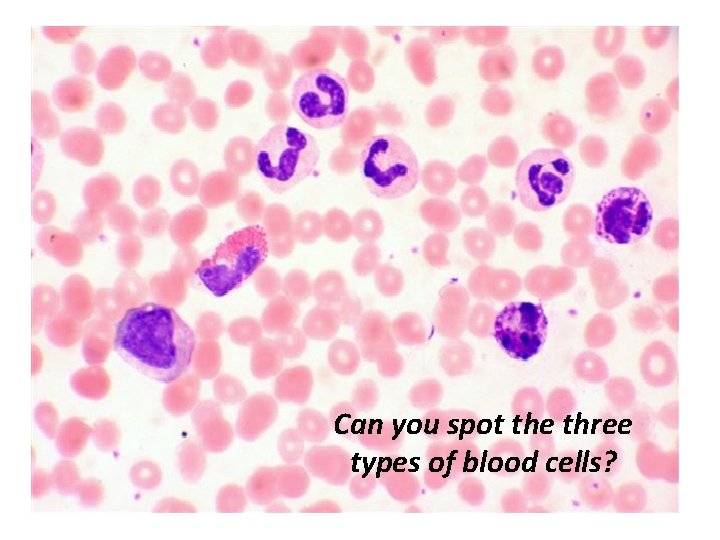 Can you spot the three types of blood cells? 