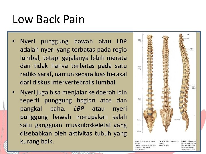 Low Back Pain • Nyeri punggung bawah atau LBP adalah nyeri yang terbatas pada
