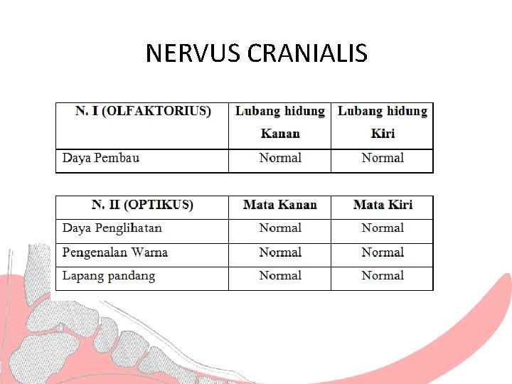 NERVUS CRANIALIS 