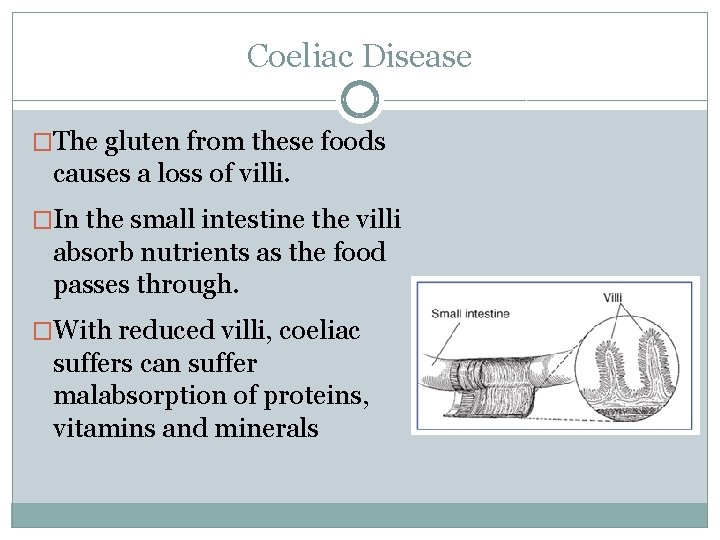 Coeliac Disease �The gluten from these foods causes a loss of villi. �In the