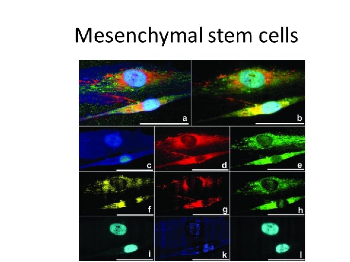 Mesenchymal stem cells J Anat. Feb 2004; 204(2): 133– 139. 
