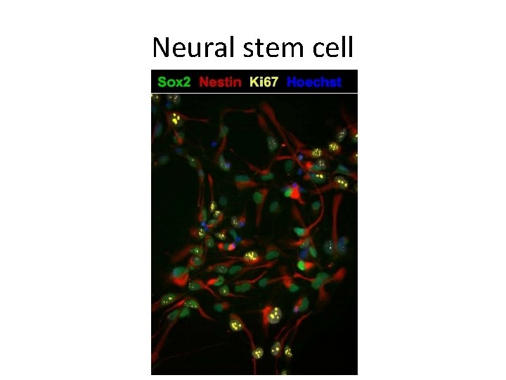 Neural stem cell 