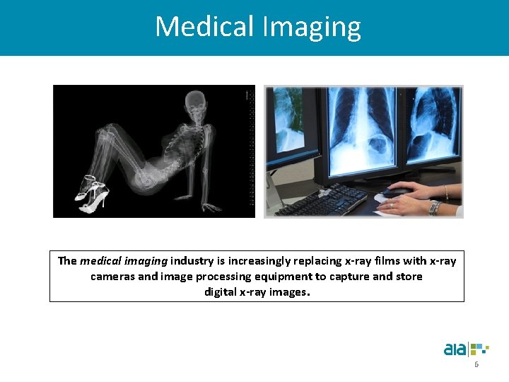 Medical Imaging The medical imaging industry is increasingly replacing x-ray films with x-ray cameras