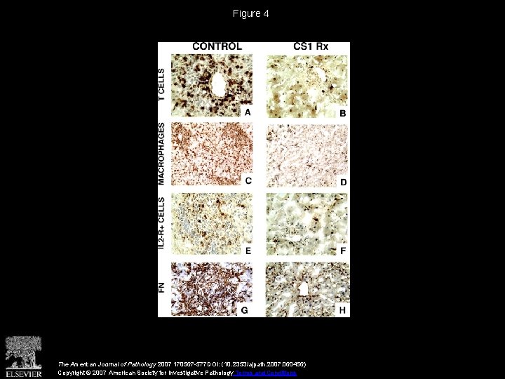 Figure 4 The American Journal of Pathology 2007 170567 -577 DOI: (10. 2353/ajpath. 2007.