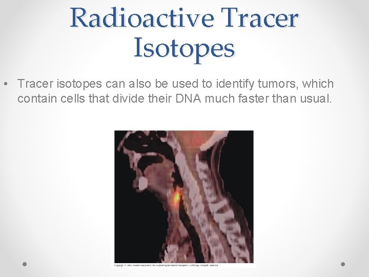 Radioactive Tracer Isotopes • Tracer isotopes can also be used to identify tumors, which