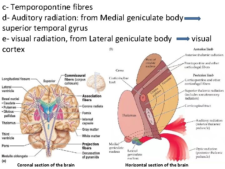 c- Temporopontine fibres d- Auditory radiation: from Medial geniculate body superior temporal gyrus e-