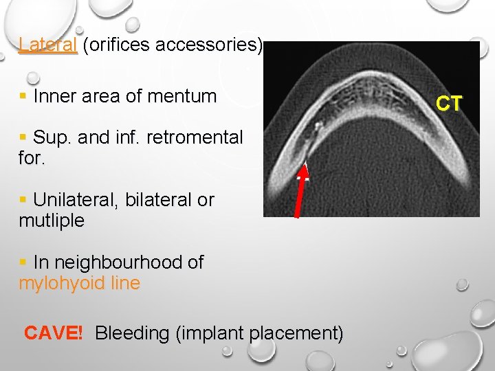 Lateral (orifices accessories) § Inner area of mentum § Sup. and inf. retromental for.