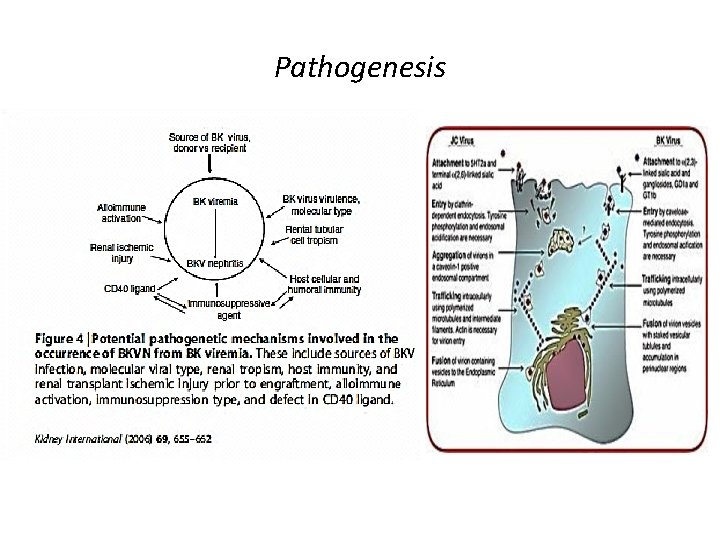 Pathogenesis 