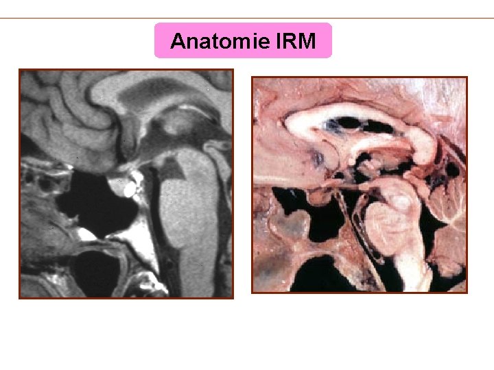 Anatomie IRM 