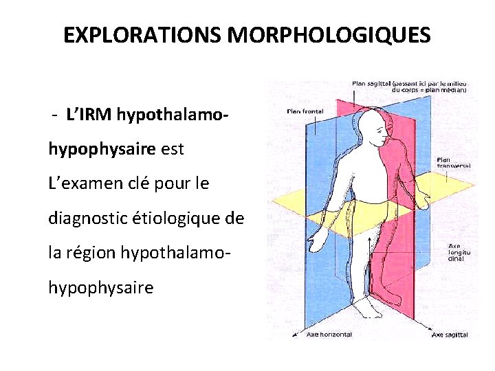 EXPLORATIONS MORPHOLOGIQUES - L’IRM hypothalamohypophysaire est L’examen clé pour le diagnostic étiologique de la