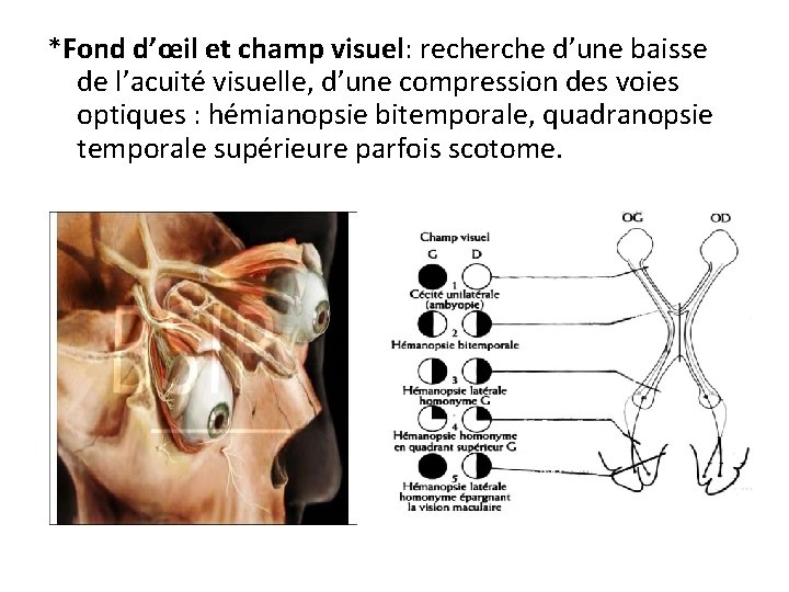 *Fond d’œil et champ visuel: recherche d’une baisse de l’acuité visuelle, d’une compression des