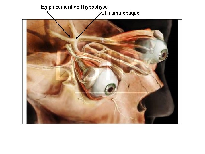 Emplacement de l’hypophyse Chiasma optique 