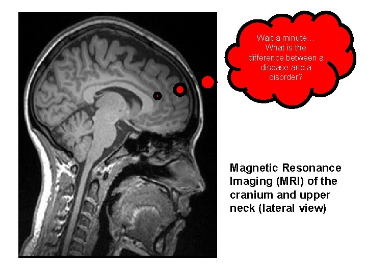Wait a minute… What is the difference between a disease and a disorder? Magnetic Wait a minute… What is the difference between a disease and a disorder? Magnetic