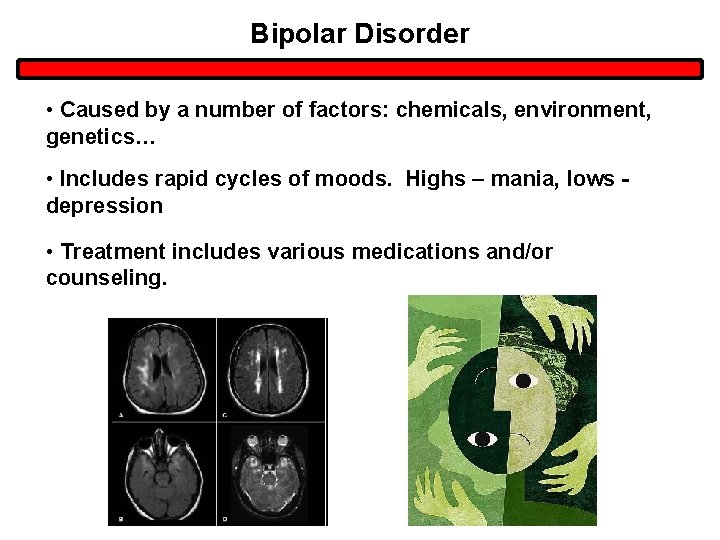 Bipolar Disorder • Caused by a number of factors: chemicals, environment, genetics… • Includes Bipolar Disorder • Caused by a number of factors: chemicals, environment, genetics… • Includes