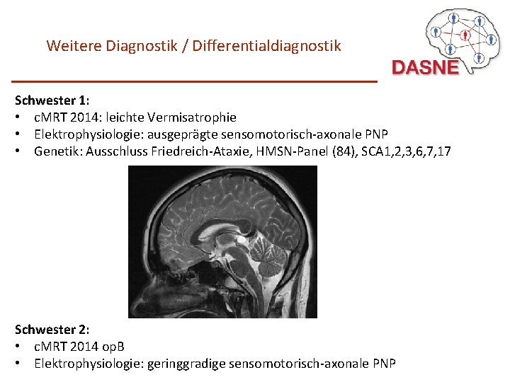 Weitere Diagnostik / Differentialdiagnostik Schwester 1: • c. MRT 2014: leichte Vermisatrophie • Elektrophysiologie: