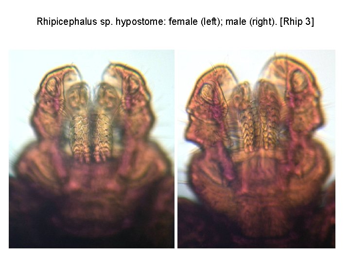 Rhipicephalus sp. hypostome: female (left); male (right). [Rhip 3] 