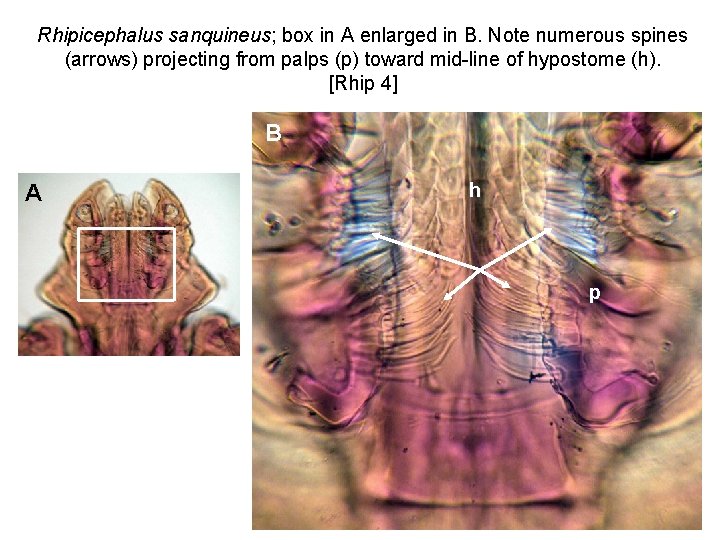 Rhipicephalus sanquineus; box in A enlarged in B. Note numerous spines (arrows) projecting from