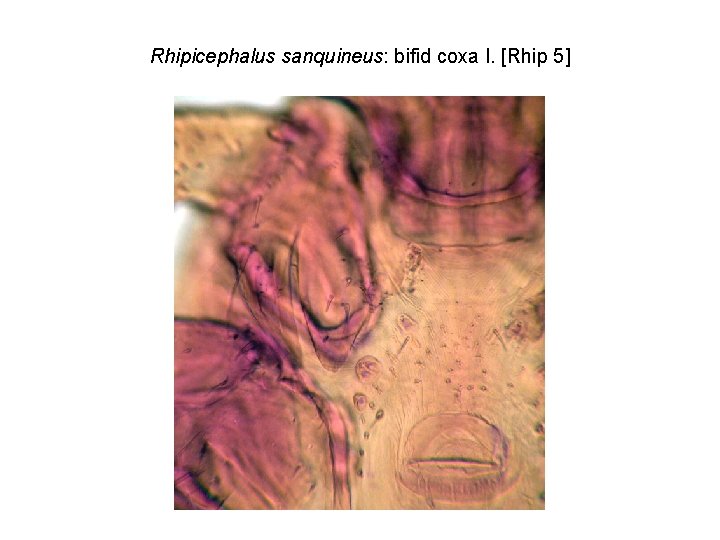 Rhipicephalus sanquineus: bifid coxa I. [Rhip 5] 